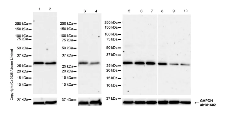 Western blot - Anti-Density Regulated Protein antibody [EPR29751-532] (AB324269)