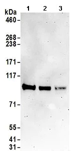 Western blot - Anti-DENTT antibody (AB168860)