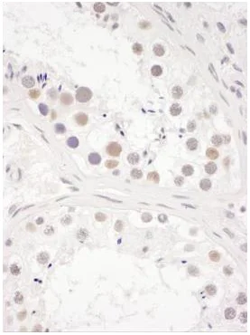 Immunohistochemistry (Formalin/PFA-fixed paraffin-embedded sections) - Anti-DENTT antibody (AB240596)