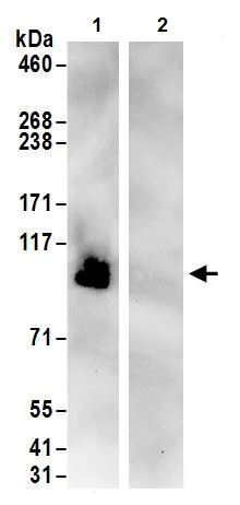Immunoprecipitation - Anti-DENTT antibody (AB240596)