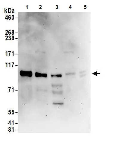 Western blot - Anti-DENTT antibody (AB240596)