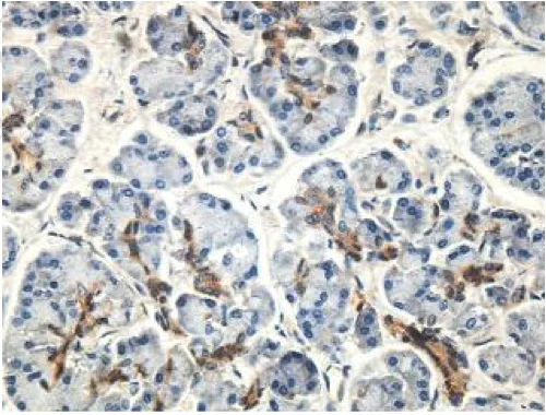 Immunohistochemistry (Formalin/PFA-fixed paraffin-embedded sections) - Anti-DEPDC1 antibody (AB197246)