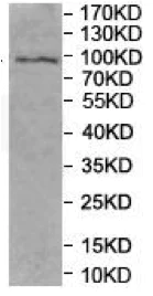 Western blot - Anti-DEPDC1 antibody (AB197246)