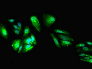 Immunocytochemistry/ Immunofluorescence - Anti-DEPDC1B antibody (AB237542)