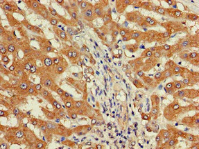 Immunohistochemistry (Formalin/PFA-fixed paraffin-embedded sections) - Anti-DEPDC1B antibody (AB237542)