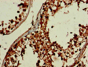 Immunohistochemistry (Formalin/PFA-fixed paraffin-embedded sections) - Anti-DEPDC1B antibody (AB237542)