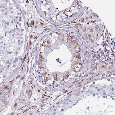 Immunohistochemistry (Formalin/PFA-fixed paraffin-embedded sections) - Anti-DEPDC5 antibody (AB241386)