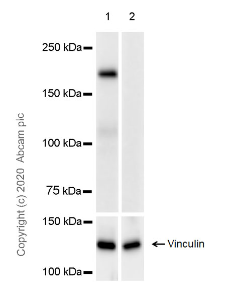 Western blot - Anti-DEPDC5 antibody [EPR20497-23] (AB213181)