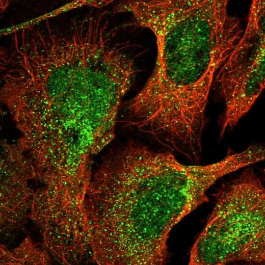 Immunocytochemistry/ Immunofluorescence - Anti-DEPP antibody (AB204429)