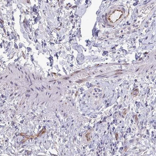 Immunohistochemistry (Formalin/PFA-fixed paraffin-embedded sections) - Anti-DEPP antibody (AB204429)