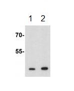 Western blot - Anti-Deptor antibody (AB191841)