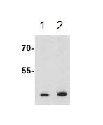 Western blot - Anti-Deptor antibody (AB191841)