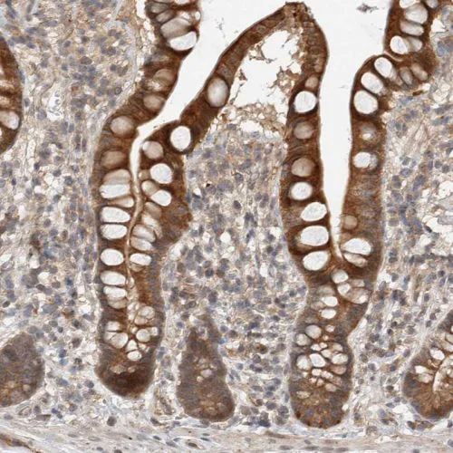 Immunohistochemistry (Formalin/PFA-fixed paraffin-embedded sections) - Anti-Deptor antibody (AB244395)