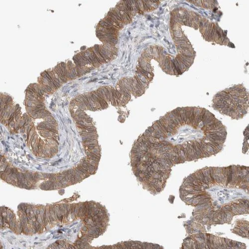 Immunohistochemistry (Formalin/PFA-fixed paraffin-embedded sections) - Anti-Deptor antibody (AB244395)