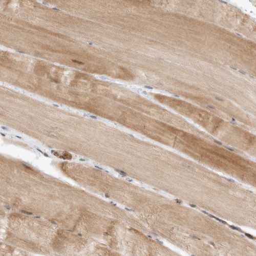 Immunohistochemistry (Formalin/PFA-fixed paraffin-embedded sections) - Anti-Deptor antibody (AB244395)