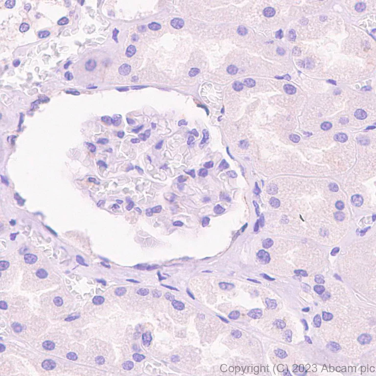 Immunohistochemistry (Formalin/PFA-fixed paraffin-embedded sections) - Anti-Deptor antibody [EPR26159-220] (AB309531)