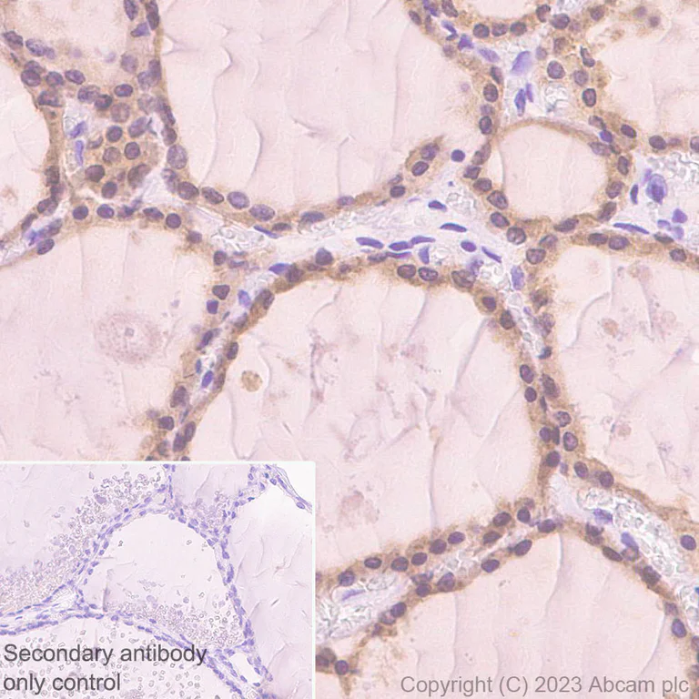 Immunohistochemistry (Formalin/PFA-fixed paraffin-embedded sections) - Anti-Deptor antibody [EPR26159-220] - BSA and Azide free (AB309532)
