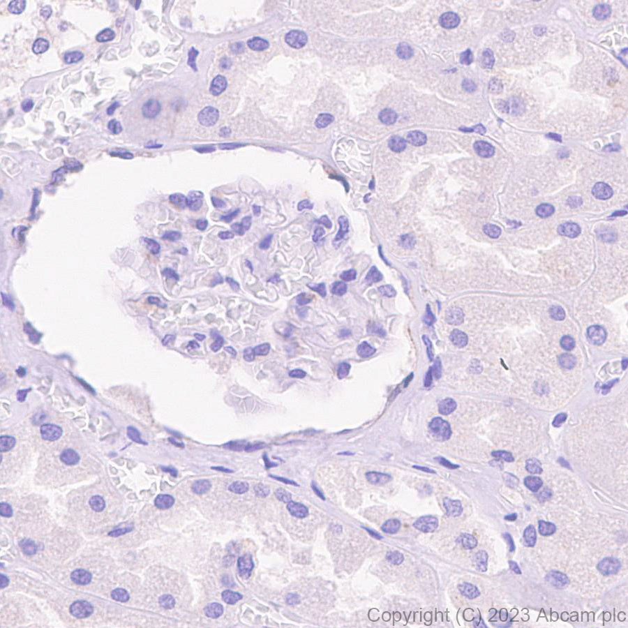 Immunohistochemistry (Formalin/PFA-fixed paraffin-embedded sections) - Anti-Deptor antibody [EPR26159-220] - BSA and Azide free (AB309532)
