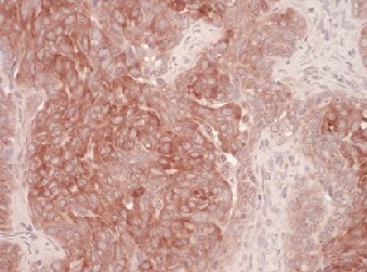 Immunohistochemistry (Formalin/PFA-fixed paraffin-embedded sections) - Anti-DERL1/Derlin-1 antibody (AB176732)
