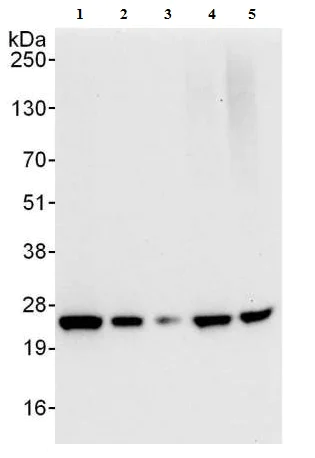 Western blot - Anti-DERL1/Derlin-1 antibody (AB176732)