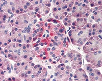 Immunohistochemistry (Formalin/PFA-fixed paraffin-embedded sections) - Anti-DERL3 antibody (AB78233)