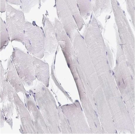 Immunohistochemistry (Formalin/PFA-fixed paraffin-embedded sections) - Anti-Derlin-2 antibody (AB185087)