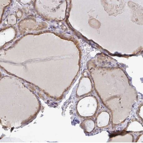 Immunohistochemistry (Formalin/PFA-fixed paraffin-embedded sections) - Anti-Derlin-2 antibody (AB185087)