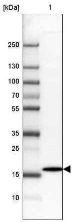 Western blot - Anti-Derlin-2 antibody (AB185087)