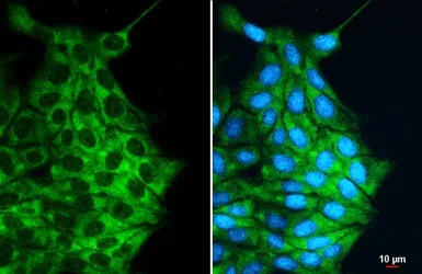 Immunocytochemistry/ Immunofluorescence - Anti-Desmin antibody (AB227224)