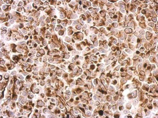 Immunohistochemistry (Formalin/PFA-fixed paraffin-embedded sections) - Anti-Desmin antibody (AB227224)