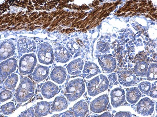 Immunohistochemistry (Formalin/PFA-fixed paraffin-embedded sections) - Anti-Desmin antibody (AB227224), expandable thumbnail