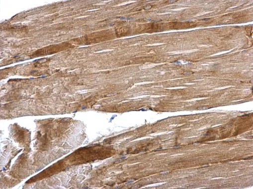 Immunohistochemistry (Formalin/PFA-fixed paraffin-embedded sections) - Anti-Desmin antibody (AB227224)