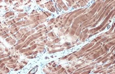 Immunohistochemistry (Formalin/PFA-fixed paraffin-embedded sections) - Anti-Desmin antibody (AB227224)