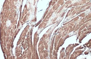 Immunohistochemistry (Formalin/PFA-fixed paraffin-embedded sections) - Anti-Desmin antibody (AB227224)