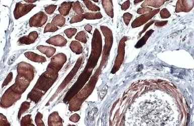 Immunohistochemistry (Formalin/PFA-fixed paraffin-embedded sections) - Anti-Desmin antibody (AB227224)