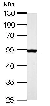 Western blot - Anti-Desmin antibody (AB227224)