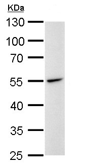 Western blot - Anti-Desmin antibody (AB227224), expandable thumbnail