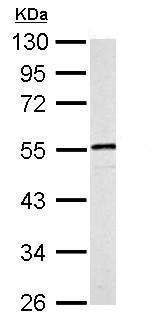 Western blot - Anti-Desmin antibody (AB227224), expandable thumbnail