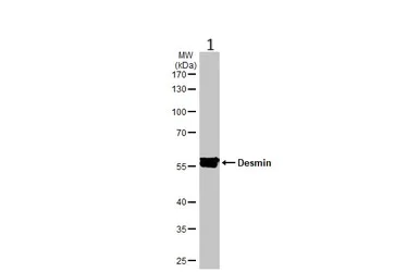 Western blot - Anti-Desmin antibody (AB227224)