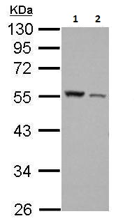 Western blot - Anti-Desmin antibody (AB227224), expandable thumbnail