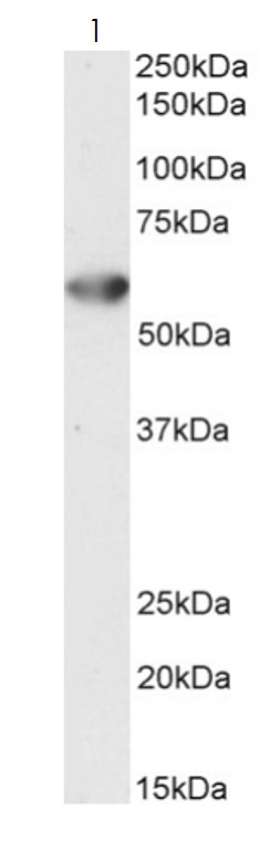 Western blot - Anti-Desmin antibody (AB80503)