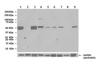 Western blot - Anti-Desmin antibody (AB8592), expandable thumbnail
