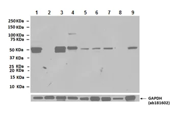 Western blot - Anti-Desmin antibody (AB8592)