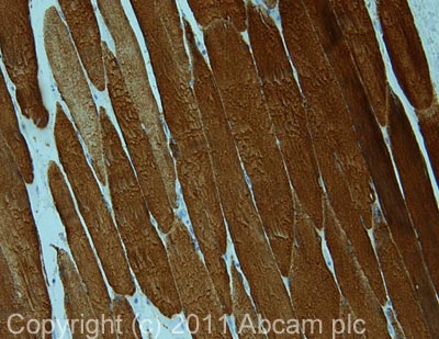 Immunohistochemistry (Formalin/PFA-fixed paraffin-embedded sections) - Anti-Desmin antibody [D33] (AB8470)