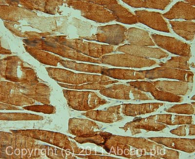 Immunohistochemistry (Formalin/PFA-fixed paraffin-embedded sections) - Anti-Desmin antibody [DE-U-10] - Cytoskeleton Marker (AB6322)