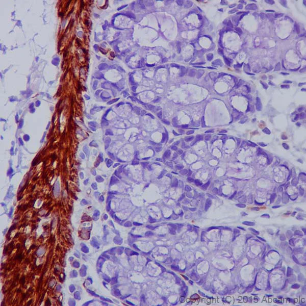 Immunohistochemistry (Formalin/PFA-fixed paraffin-embedded sections) - Anti-Desmin antibody [DE-U-10] - Cytoskeleton Marker (AB6322)