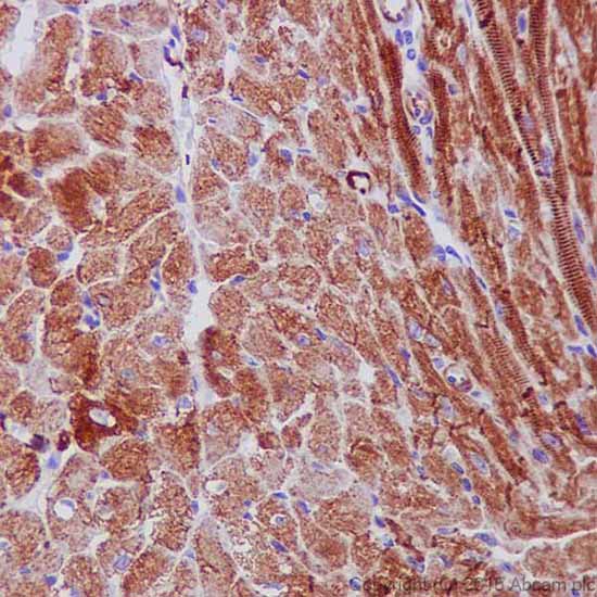 Immunohistochemistry (Formalin/PFA-fixed paraffin-embedded sections) - Anti-Desmin antibody [DE-U-10] - Cytoskeleton Marker (AB6322)