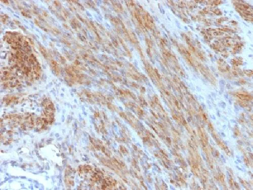 Immunohistochemistry (Formalin/PFA-fixed paraffin-embedded sections) - Anti-Desmin antibody [DES/1711] - BSA and Azide free (AB269739)