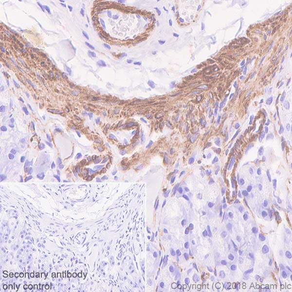 Immunohistochemistry (Formalin/PFA-fixed paraffin-embedded sections) - Anti-Desmin antibody [SP138] - BSA and Azide free (AB243931)