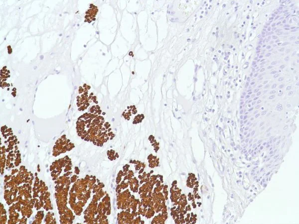 Immunohistochemistry (Formalin/PFA-fixed paraffin-embedded sections) - Anti-Desmin antibody [SP138] - BSA and Azide free (AB243931)